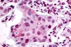 S1P2/EDG-5/S1PR2 Antibody, Novus Biologicals 50 &mu;g; Unconjugated:Antibodies,